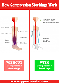 How Compression Stockings Work Compression Stockings Benefits Compression Stockings Compression Gear