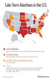 Where Does Your State Stand On Late Term Abortions