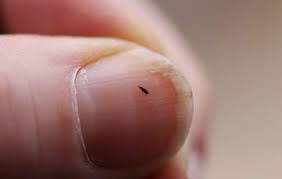 A flea infested house is incredibly difficult to treat, even for professionals. Fleas Control House Treatment Pest Control Services In Manchester
