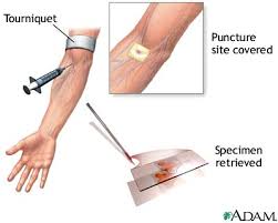 Image result for GnRH Stimulation Test