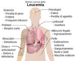 We did not find results for: Leucemia I Sintomi Da Riconoscere