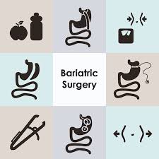 Bariatric surgery is a term that encompasses several procedures. Is Bariatric Surgery Reversible Weightloss And Wellness Center