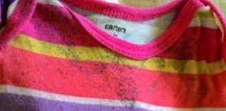 Akibatnya jaringan tahi lalat akan rusak akibat terbakar. Tahi Lalat Archives Keluarga