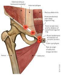 You can put the root words together to get a muscle that goes from the pubic bone. Groin Pain In Athletes The Bmj