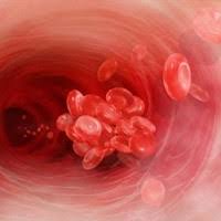Sepsis boleh menyebabkan keradangan dalam badan. Darah Membeku Yang Mengancam Jiwa
