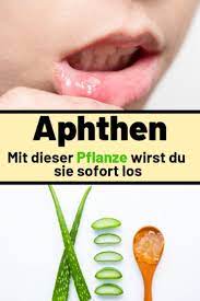 Unglaublich Das Hilft Wirklich Gegen Aphthen Hypnobirthing Fitness Rezepte Life Hacks