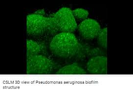 Pseudomonas infection causes and risk factors. 10 Facts About Pseudomonas Aeruginosa Proeconomy
