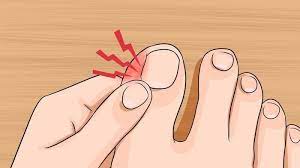 Antara ibu jari dan jari telunjuk terdapat titik yang tidak keras yang merupakan titik pijat yang dapat mengobati sakit atau nyeri pada gigi. Nyeri Akibat Cantengan Di Jempol Kaki Lakukan 4 Cara Sederhana Ini Pos Belitung