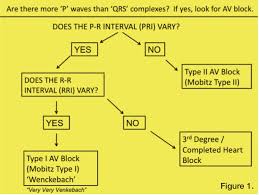 Heart Blocks Understanding Which Is Which Cath Lab Digest