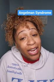 Welcome to #teachingtuesday ! Getting a proper diagnosis for ANY condition  is so important! It helps you research, treat, find a community of other  families that may help with your journey, and, to ...