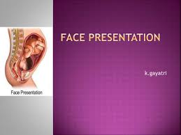 Image result for Face Presentation
