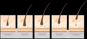 Anagen effluvium, meanwhile, is when hair leaves its anagen phase due to chemotherapy or other toxic exposure. How Does Hair Loss Occur Curavi