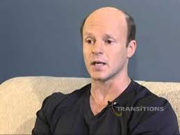 Body hair loss could be caused by medication Shawn Began Going Bald At The Age Of 23 Visit Https Transitionsindy Com Patient Shawn To Hear Shawn S Stor Baldness Solutions Hair Loss Solutions Hair Loss