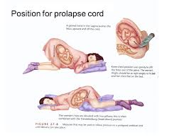 Pin On Nursing