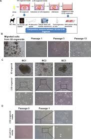 Increased coughing can also be a less common sign of bladder cancer along with labored breathing. Establishment Of 2 5d Organoid Culture Model Using 3d Bladder Cancer Organoid Culture Scientific Reports