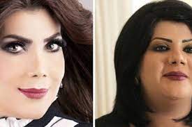 الحان الدكتور جمال سلامةالجروب الرسمى للديفا سميرة. ÙÙ†Ø§Ù†Ø§Øª Ø¹Ø±Ø¨ÙŠØ§Øª Ù‚Ø¨Ù„ ÙˆØ¨Ø¹Ø¯ Ø¹Ù…Ù„ÙŠØ§Øª Ø§Ù„ØªØ¬Ù…ÙŠÙ„ Ø£ÙˆØ±ÙŠÙˆÙ† Ù…Ø§