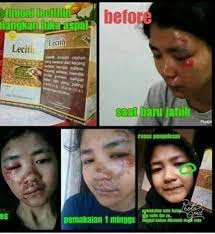 Manfaat Lengkap Natural Lecithin Nasa 1 Agen Resmi Nasa Gresik Facebook