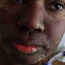 Fundraiser by Yvonne Collins : Kidney Transplant