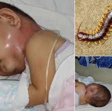 Cece Vegas - Never EVER kill a house centipede again. I had no idea. Check  the comments👇 | Facebook