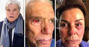 He has been at the centre of legal battles concerning corruption and fraud for decades, and. Son Bernard Tapie Shows Photos Injured Parents After Violent Robbery Cceit News