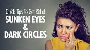 Learn which dark spot skin treatments actually work. All About Dark Circles And How To Remove Them Permanently Femina In