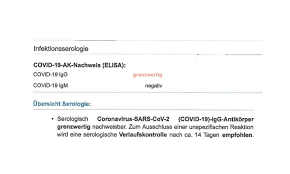 Die unterschiedlichen interpretationen der möglichen ergebnisse von antigentests. Coronavirus Antikorper Test Grenzwertig Mogliche Ursachen Niederosterreich