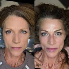 Eyebrows 🤨 The only thing can get into shape without exercising 💪 I am in  love with how her new brows open and lift those gorgeous eyes! 🤩 This babe  works out