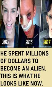 Whatever he did, he was told that he would never write another of human bondage! He Spent Millions Of Dollars To Become An Alien This Is What He Looks Like Now Romantic Novel 22 Years Old Bizarre Pictures