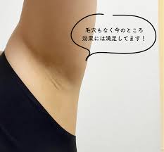 湘南美容クリニックの悪い口コミ・評判の真相と脱毛効果を徹底分析！ 【ファイヤークリニック】脱毛コラム「FIRE脱毛」