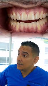 🦷 Cuando los dientes se desgastan adelante… los de atrás también comienzan  a perder su forma., Y con el tiempo, esa pérdida cambia tu manera de  masticar, hablar e incluso la forma de tu rostro., La ...