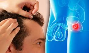 As the cancer grows, you may have trouble urinating. Prostate Cancer Symptoms Tumour Signs Include Hair Loss Express Co Uk