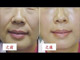 youtube フェイスケア 顔のエクササイズ フェイスマッサージ