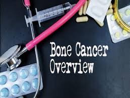 Here are the warning signs. What You Need To Know About Bone Cancer