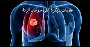 علامات مبكرة على سرطان الرئة طبيب نت
