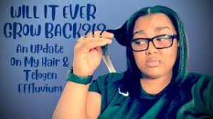 WILL IT EVER GROW BACK?!? An Update On My Hair & Telogen Effluvium  #TelogenEffluvium