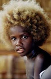 Is it possible to have one black parent and one white parent but still look  white?