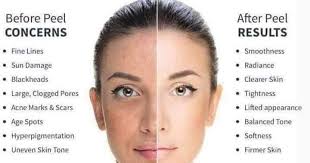 Just check what you want then you will see reasonable price and great offers. Vsl Beauty Care Ovivi Enterprise Pg0476694 W