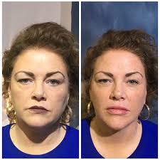 Angela Oh-Park Antipin, MD (@drangelasaestheticclinic) · Ridgeway, VA