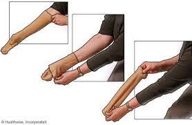 How To Put On Compression Stockings Metro Health Hospital Metro Compression Stockings Stockings Put On