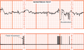 Fetal Assessment Williams Obstetrics 24e Accessmedicine