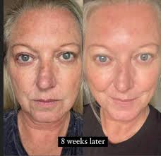 Hi. I b ought 2 x COSRX snail mucin from SUPERBALIST How would I clarify if  it's authentic or not?