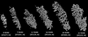 Bones without the cancellous mass have a medullary cavity. Ontogenetic Changes To Bone Microstructure In An Archaeologically Derived Sample Of Human Ribs Beresheim 2020 Journal Of Anatomy Wiley Online Library