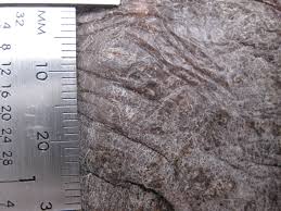 Image result for Lichen Simplex Chronicus