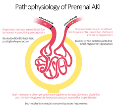 Chronic renal failure is a slow, progressive decline of kidney function. Acute Renal Failure Pathophysiology Wikidoc