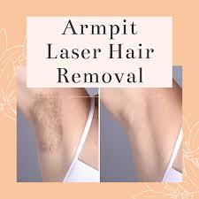 Some rules are not meant to be broken, niki says. Legitimate Decrepit Flashy Underarm Laser Hair Removal Ercantastorie Com