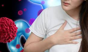 Patients should not feel the need to ask all their questions or remember all the answers at one time. Stomach Cancer Symptoms Signs Include Frequent Hiccups Express Co Uk