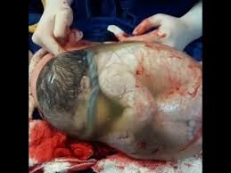The Miracle Of A Rare Delivery En Caul Birth Youtube