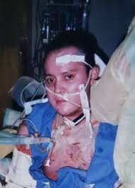 Kitchen fires are focus of Burn Awareness Week