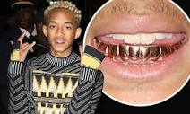 Jaden Smith shows off gold grills at Louis Vuitton bash | Daily ...