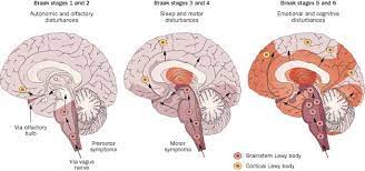 Olfactory Dysfunction In Parkinson Disease Nature Reviews Neurology